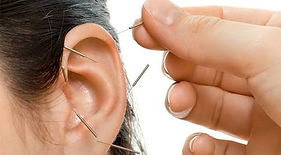 Auriculoterapia: Estimula puntos en la oreja para tratar problemas de salud y promover el bienestar.