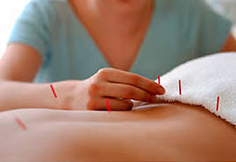 Acupuntura: Usa agujas finas en puntos específicos para equilibrar la energía del cuerpo y favorecer la curación natural.
