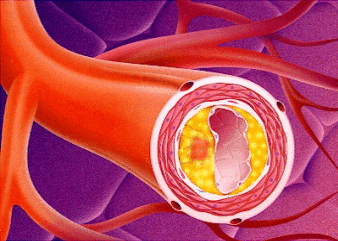 Aspirina migliora l'outcome nello scompenso cardiaco