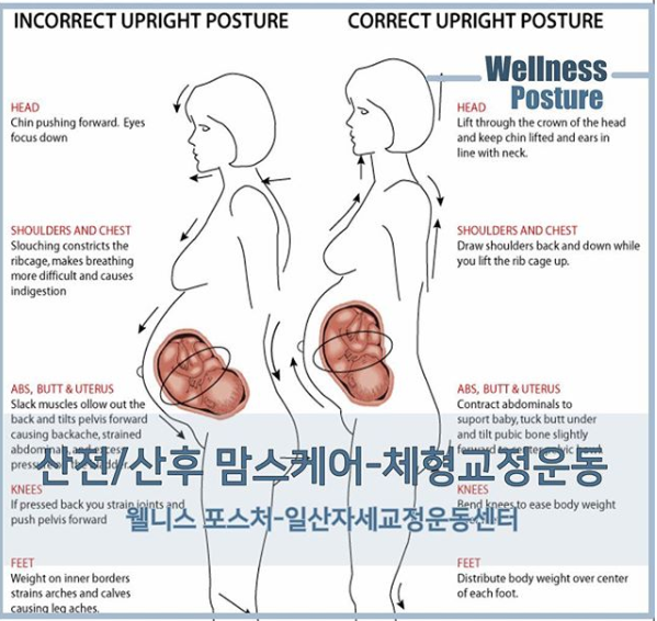 일산산후관리