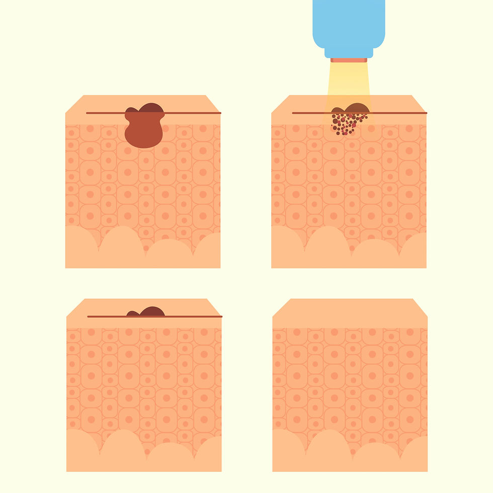 rederm_pico illustration mobile.jpg