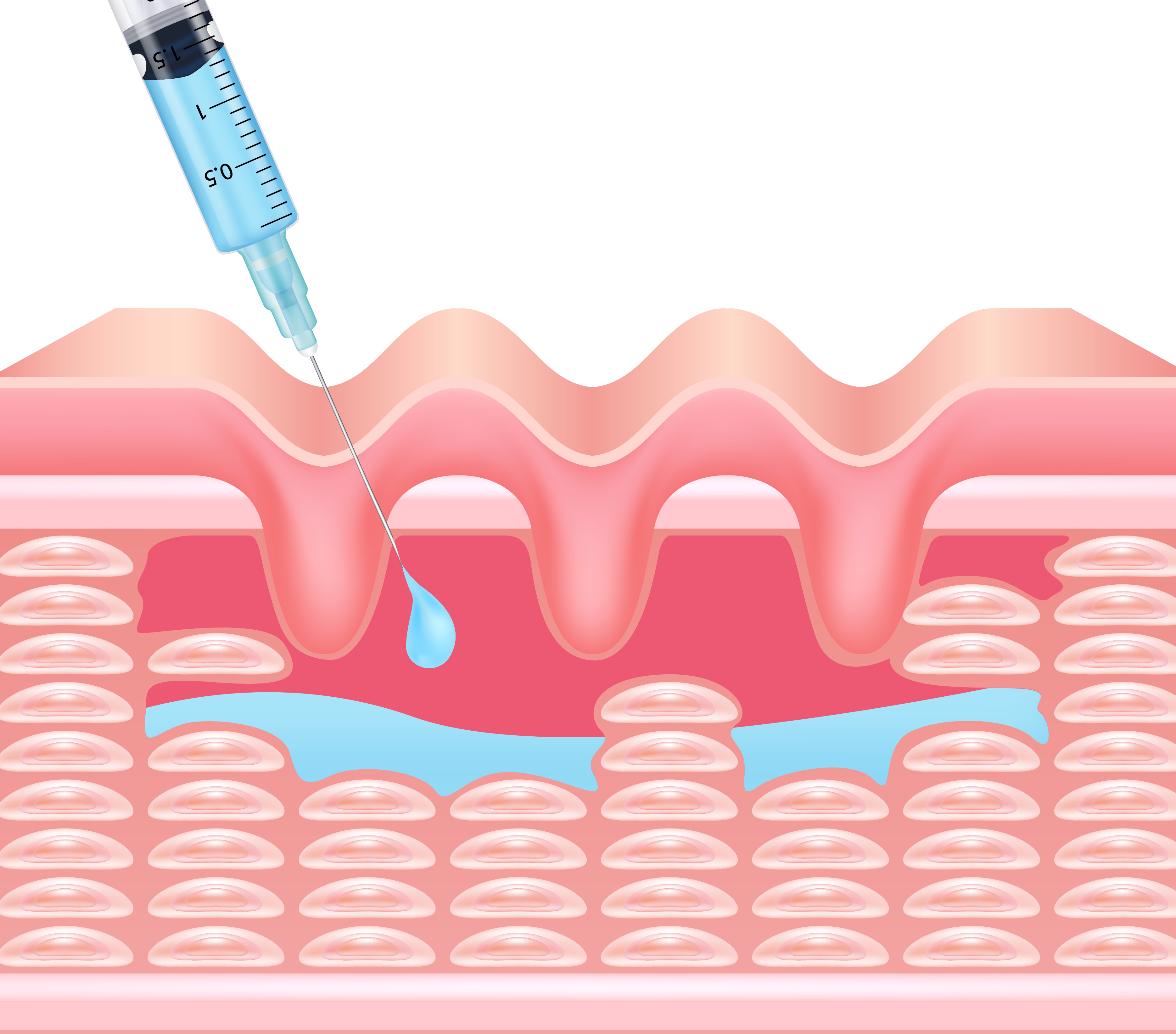 collagen replacement-01.png