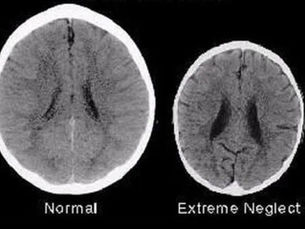 Love Helps Children's Brain Development