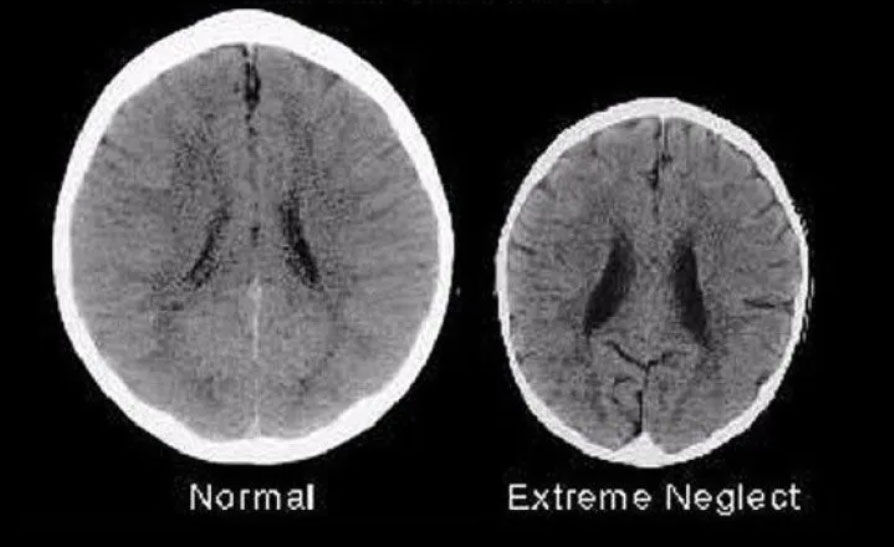 Love Helps Children's Brain Development