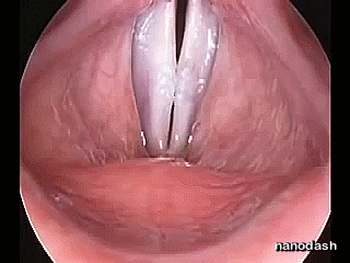 gif c v.gif