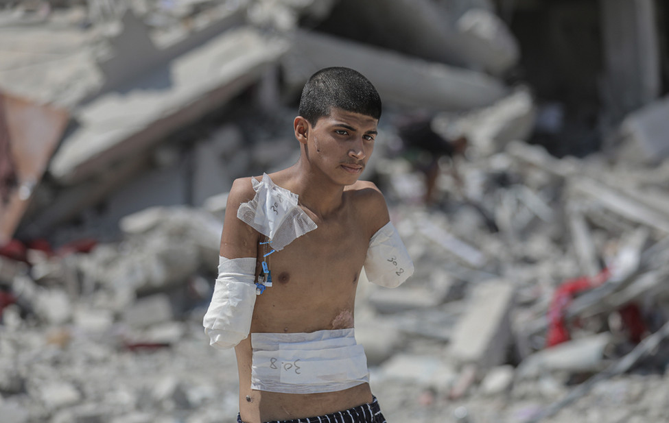 A wounded Palestinian after an Israeli strike in Gaza.
