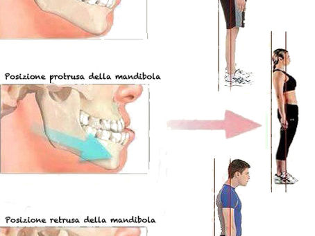 Denti e Postura