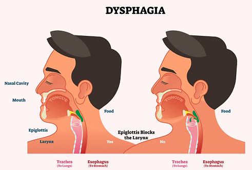 dysphagia-causes.png