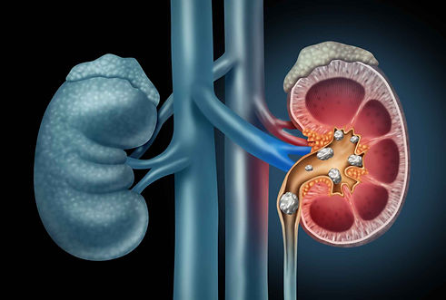 Kidney-1.jpg