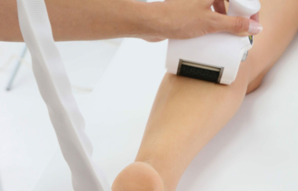 icoone®-behandeling-benen-amsterdam-beauty-mind.jpg