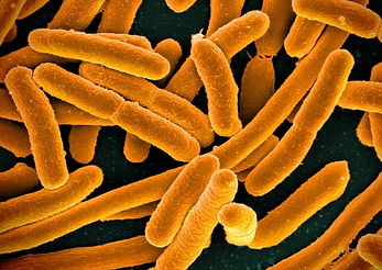 E. coli Bacteria by NIAID Orange.jpg