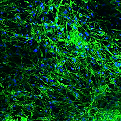 Honored to have our work on engineered skin substitutes for burn healing featured in Medical Press, highlighting the clinical potential of our research in regenerative medicine.