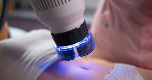 lumme_sculpt_skinzzo_lab_oblikovanje_telesa_slimming