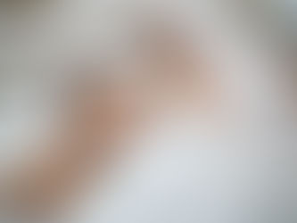 Ronquidos en jóvenes: ¿problema menor o señal de apnea?