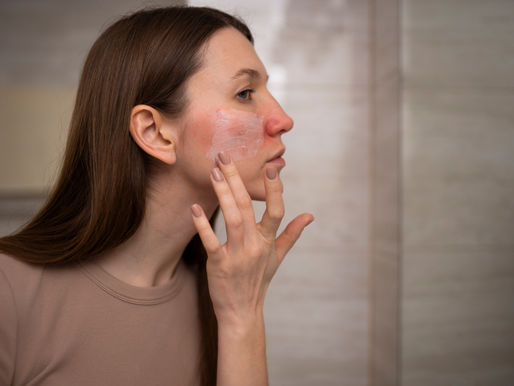 Cuando el sistema inmune ataca al propio cuerpo: lupus en jóvenes