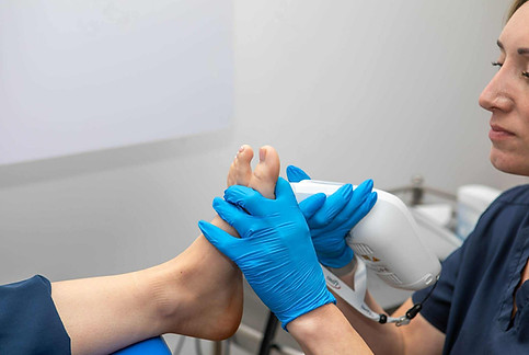 A podiatrist using the handheld Swift Pro devicce to treat a verruca.