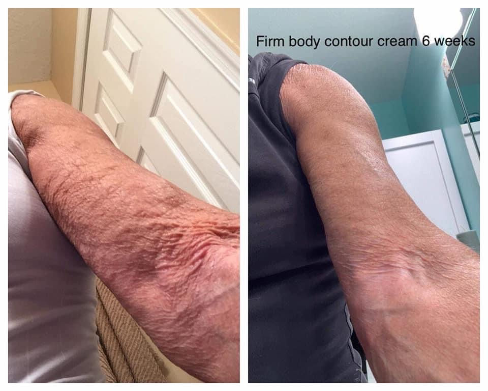 Thumbnail: Neora Firm Contouring Cream