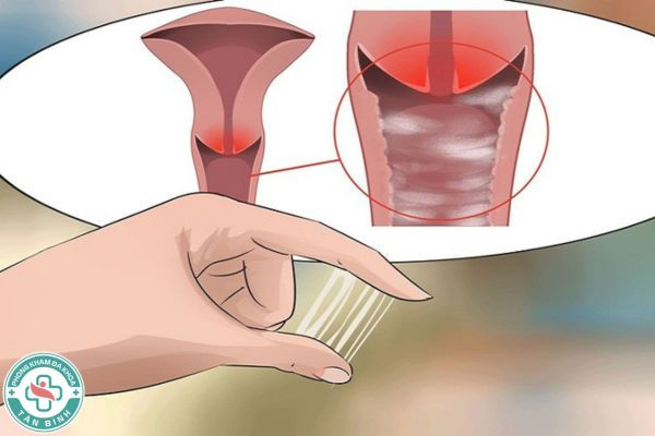 99+ dấu hiệu cảnh báo khi mang thai khiến bạn phải đi khám thai gấp