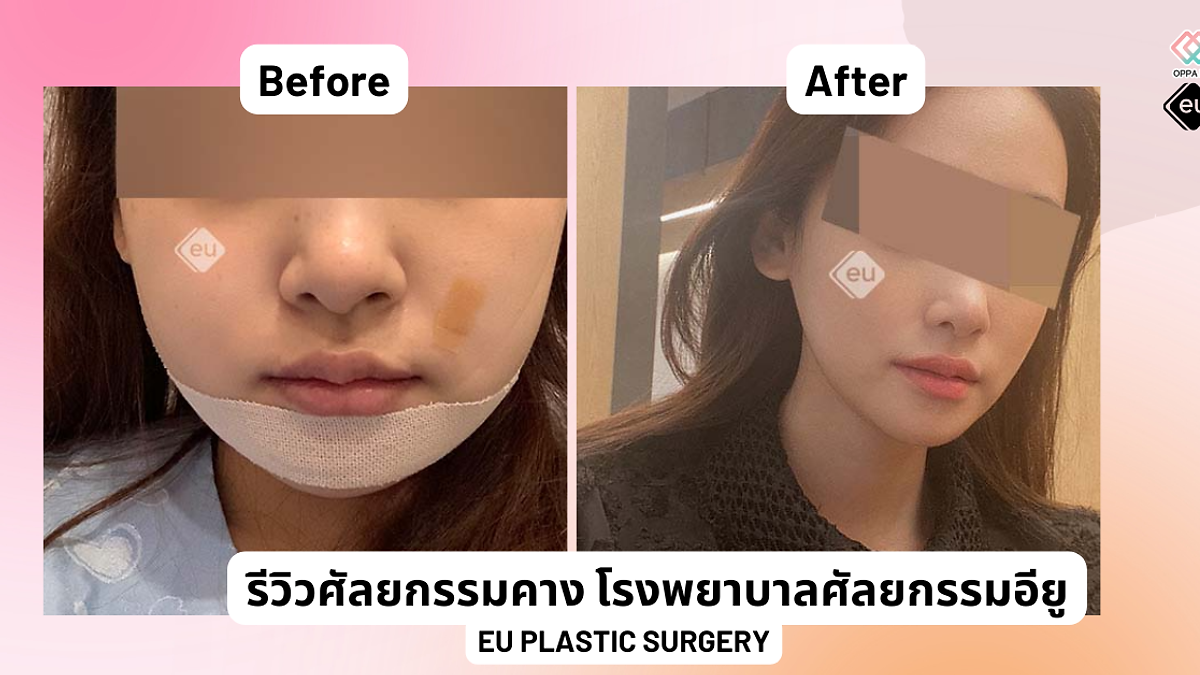 Cover image for the Korean plastic surgery hospitals section