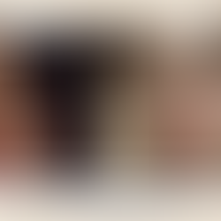 การทำศัลยกรรมลดขนาดโหนกแก้ม โรงพยาบาลศัลยกรรมอียู (EU Plastic Surgery)