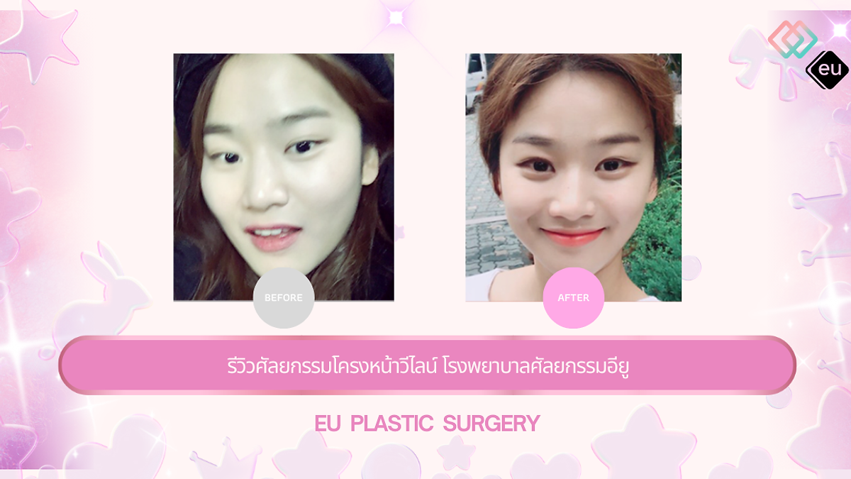 Cover image for the Korean plastic surgery hospitals section