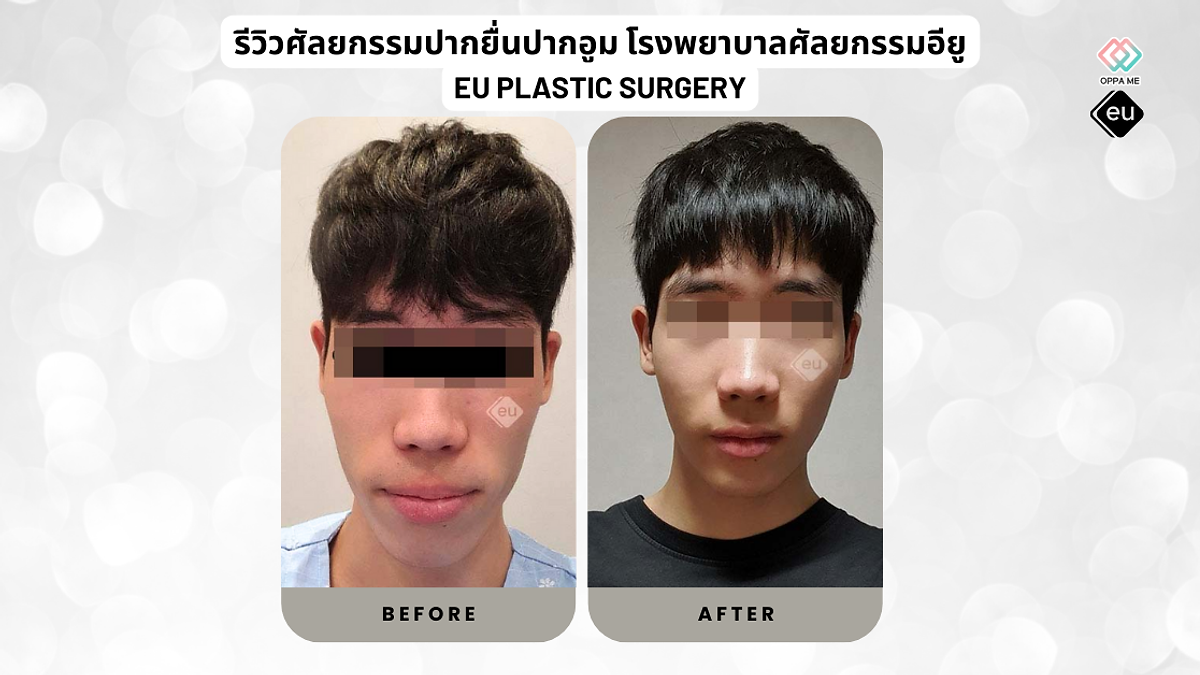 Cover image for the Korean plastic surgery hospitals section