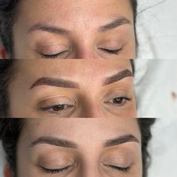 sourcils cicatrisés
