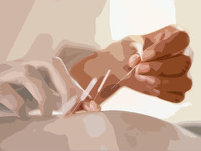 Acupuncture For Chronic Pain Relief