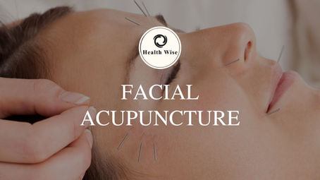 Facial Acupuncture: A Natural Approach to Rejuvenation