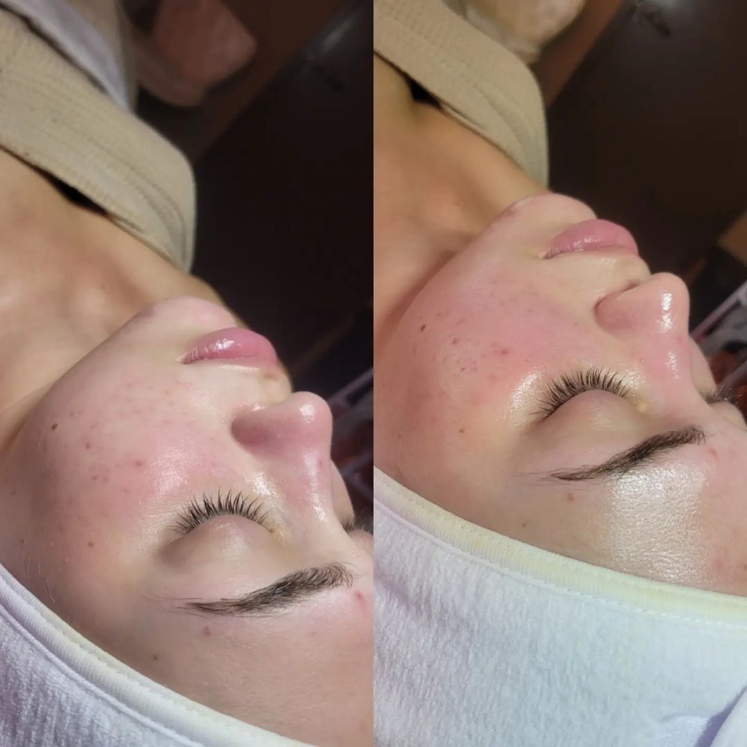 facials at Glo by Gypsy, a spa in Winter Park, FL
