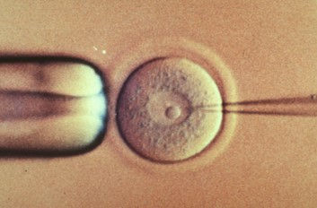 BAC Transgenesis