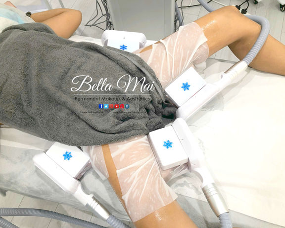 Cryolipolysis fat freezing on love handles and inside legs - Bella Mai Essex body contouring.