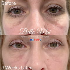 Tear Trough Training in Thurrock, Essex. Bella Mai Academy