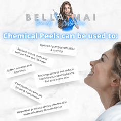 Medium grade chemical peel application in clinical Grays clinic