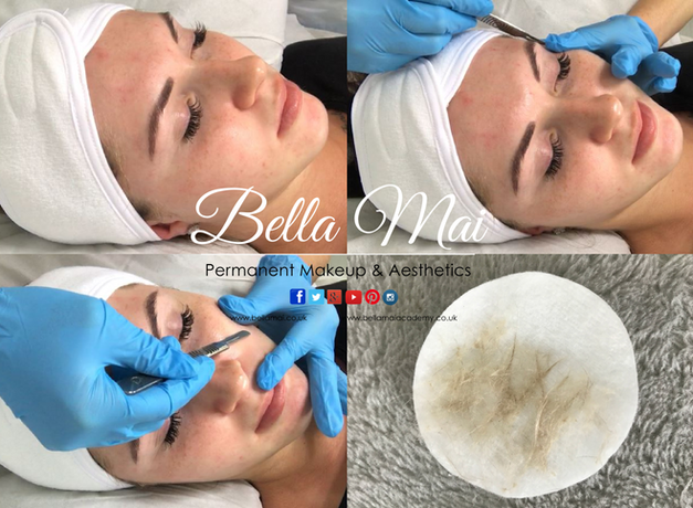 Dermaplaning results for glowing skin Grays