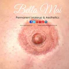 Hyper-realistic 3D areola and nipple tattoo restoration after mastectomy Grays Essex