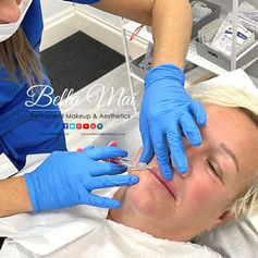 Natural lip dermal filler Bella Mai Essex
