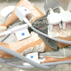 Cryolipolysis fat reduction on the abdomen, inside and outside legs - Bella Mai Essex body contouring.