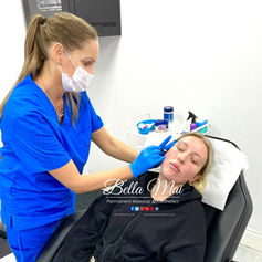 Cheek dermal fillers Bella Mai Essex
