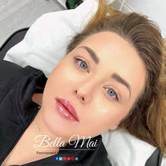 Natural lip dermal filler Bella Mai Essex