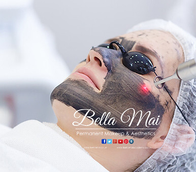Carbon Laser Facial before and after acne results Grays Essex