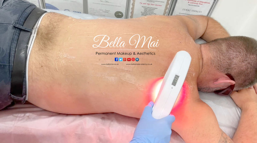 SHR Laser Hair Removal back for men Bella Mai Essex