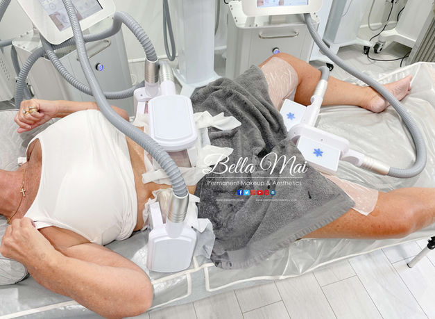 Cryolipolysis fat freezing on abdomen and inside legs - Bella Mai Essex body contouring.