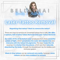 Laser tattoo removal before and after results Grays Essex