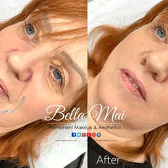 ProQual Level 7 Ofqual Regulated Diploma in Aesthetic Practice Training in Thurrock Essex. Bella Mai Academy