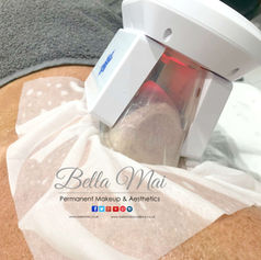 Cryolipolysis fat freezing on back fat - Bella Mai Essex body contouring.
