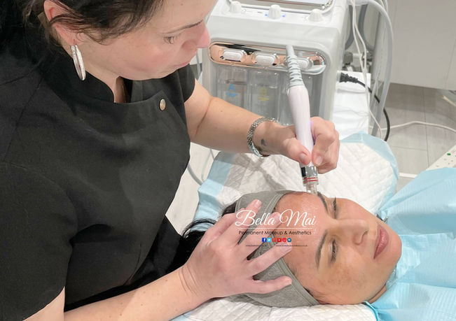 Hydro Facial results Essex