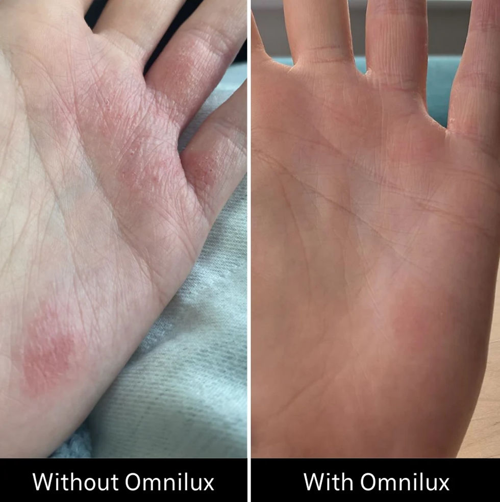 Thumbnail: Omnilux Contour LED Therapy Glove for hand rejuvenation and joint pain relief - Bella Mai Academy