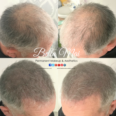 ProQual Level 4 Ofqual Regulated Certificate in Scalp Micropigmentation Training in Thurrock Essex. Bella Mai Academy