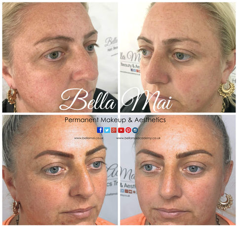 Eyebrow Microblading Before & After Grays Essex